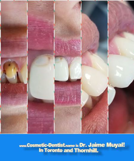 Dr. Muyal Cosmetic Dentistry Collage